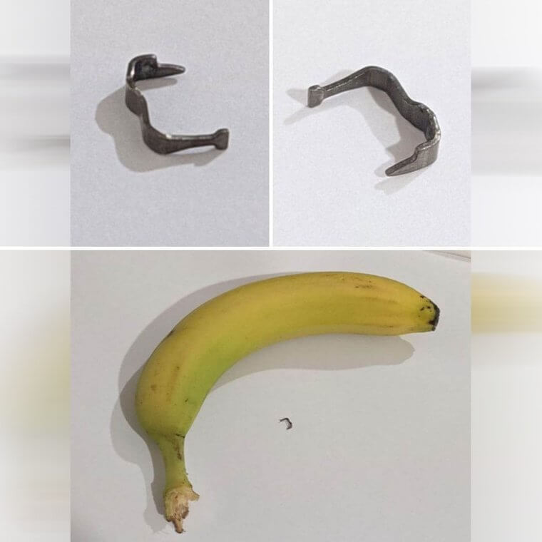 Someone Found Metal In Their Meal